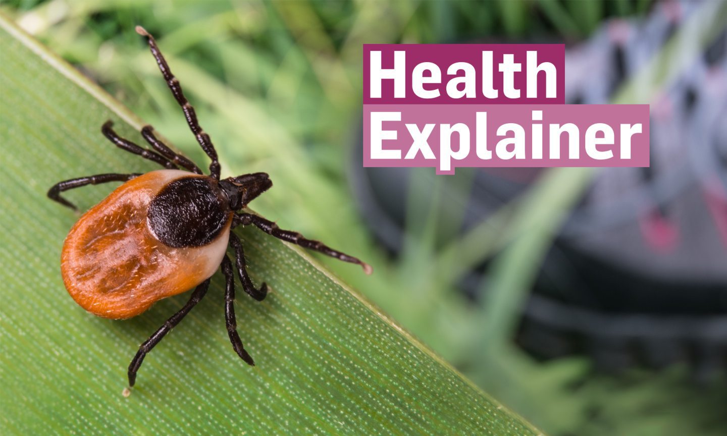 I Ve Been Bitten By A Tick What Do I Do   Health Explainer Ticks 32npahil9 