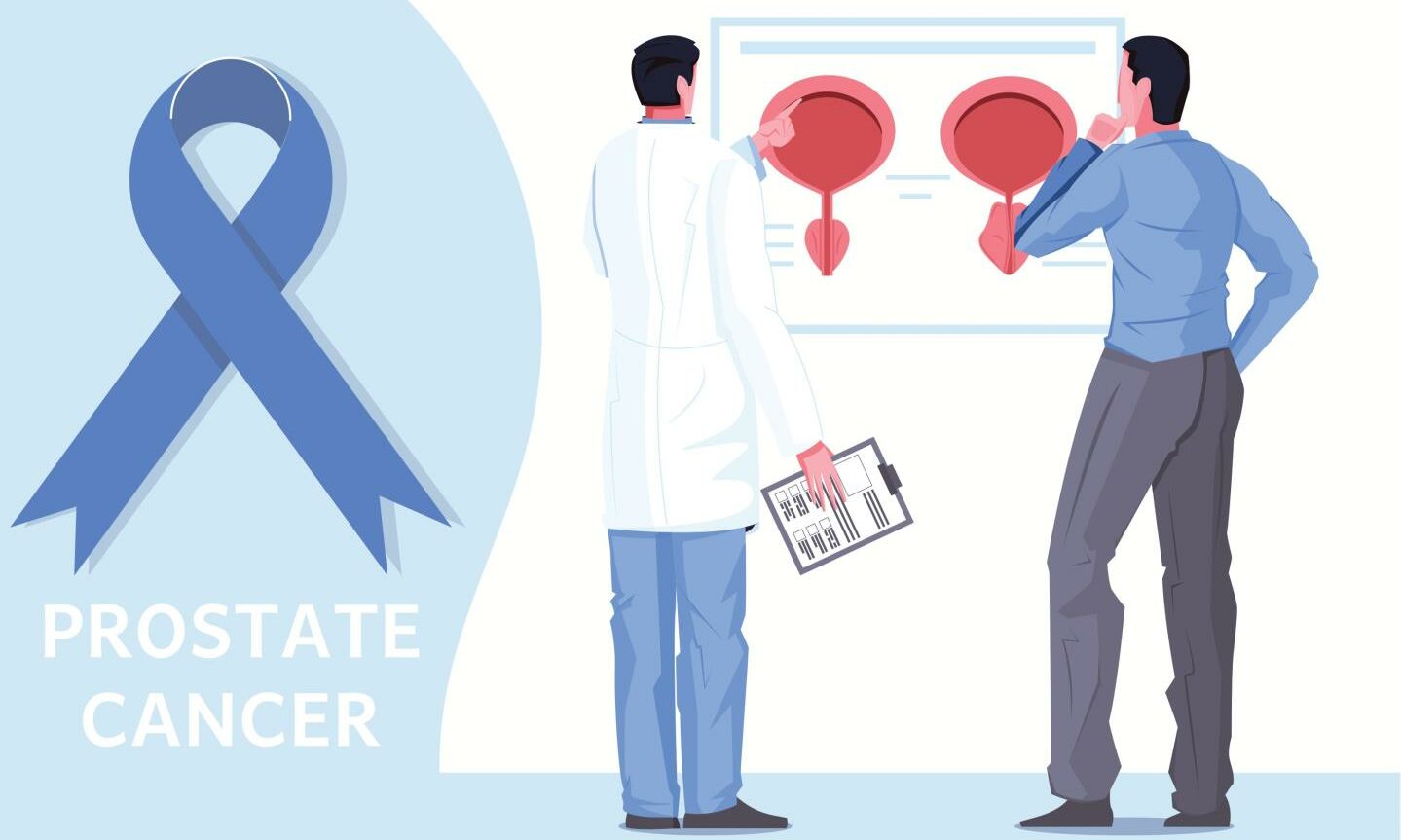 5 Things You Should Know About Prostate Cancer